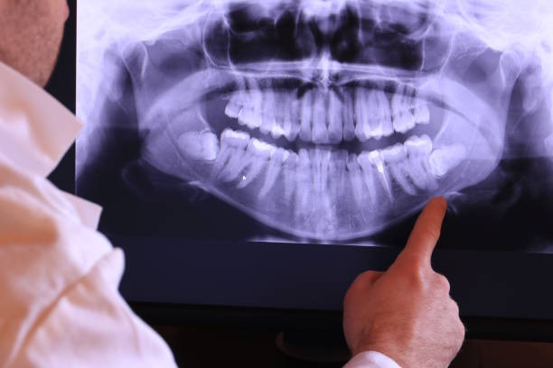 Best Emergency Root Canal Treatment in Mount Olive, NC