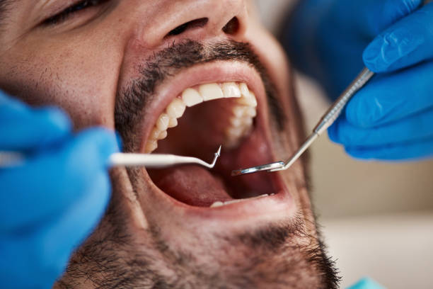 Best Emergency Dentist for Special Needs Patients in Mount Olive, NC